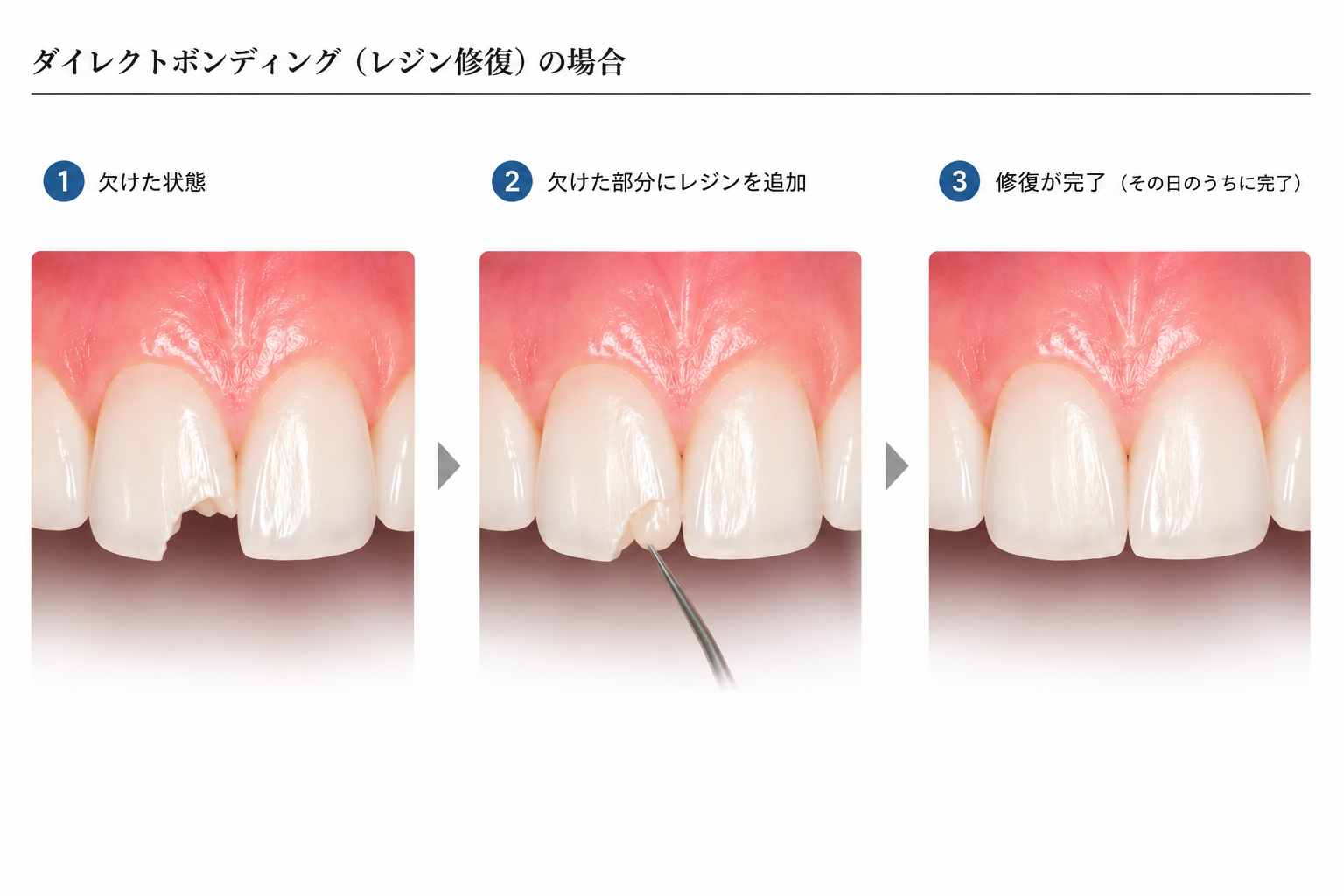 ダイレクト解説