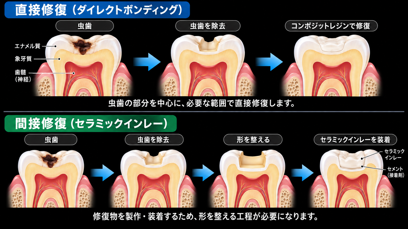 直接と間接の比較