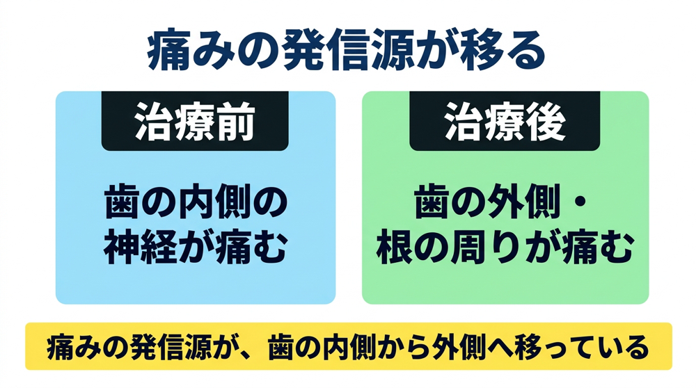 神経を取ったのに、なぜ痛むのか